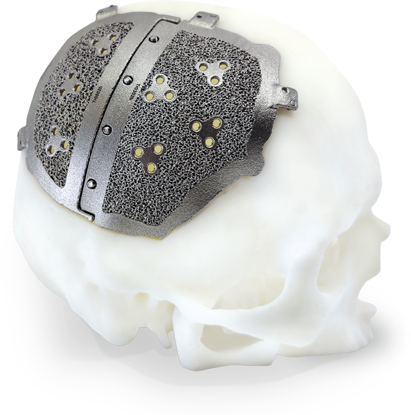 3D SURGICAL Biomodels